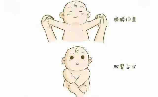 【健康科普】什么是肌张力