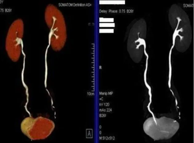 联影有哪些CT我院放射科再添“硬核“利器—联影60排120层螺旋CT机_https://www.jmylbn.com_新闻资讯_第38张