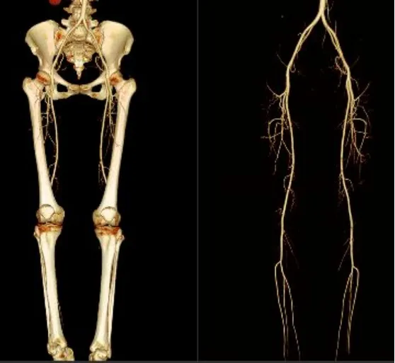联影有哪些CT我院放射科再添“硬核“利器—联影60排120层螺旋CT机_https://www.jmylbn.com_新闻资讯_第36张