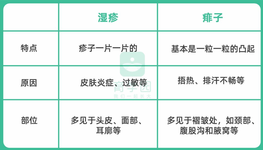 爽身粉、花露水不治痱子！這種藥才最管用，家門口藥店就有 親子 第7張