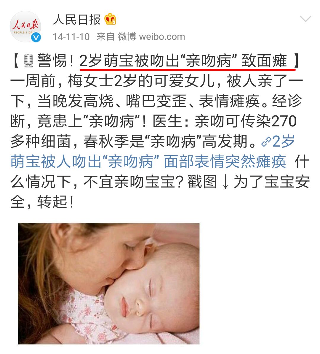 因一個親吻，孩子險失明！別再亂親孩子了！ 親子 第4張