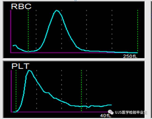 rbc直方图怎么看【小结】常见血细胞分析仪的检测原理与直方图／散点图_https://www.jmylbn.com_新闻资讯_第3张