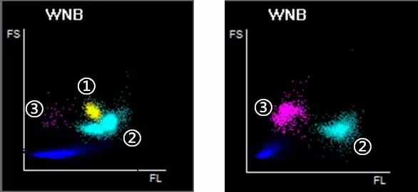 rbc直方图怎么看【小结】常见血细胞分析仪的检测原理与直方图／散点图_https://www.jmylbn.com_新闻资讯_第21张