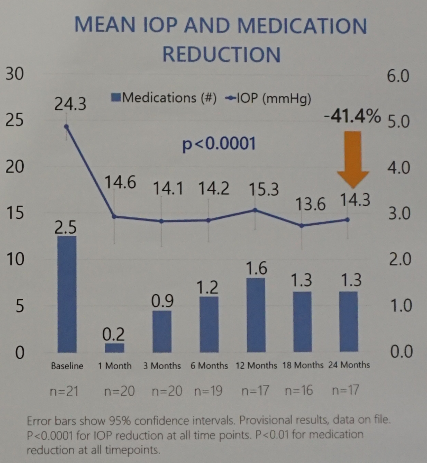 怎么装青光眼EGS2024丨独辟蹊径，观睫上引流装置应用于难治性开角型青光眼的长期随访结果_https://www.jmylbn.com_新闻资讯_第5张