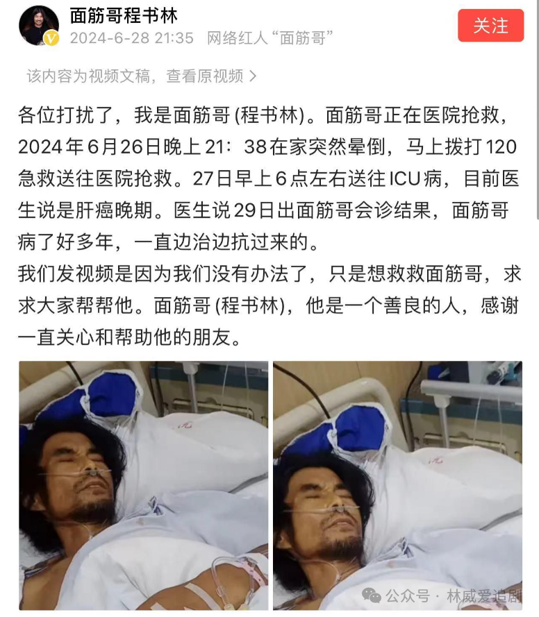 网红面筋哥肝癌晚期进ICU