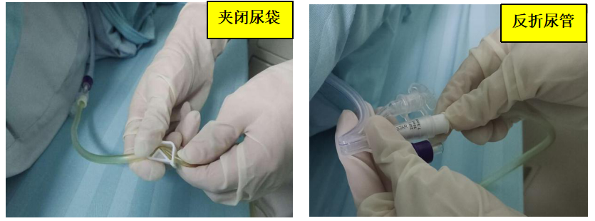 为什么要引流尿袋【科普】留置尿管患者如何进行居家护理？_https://www.jmylbn.com_新闻资讯_第7张