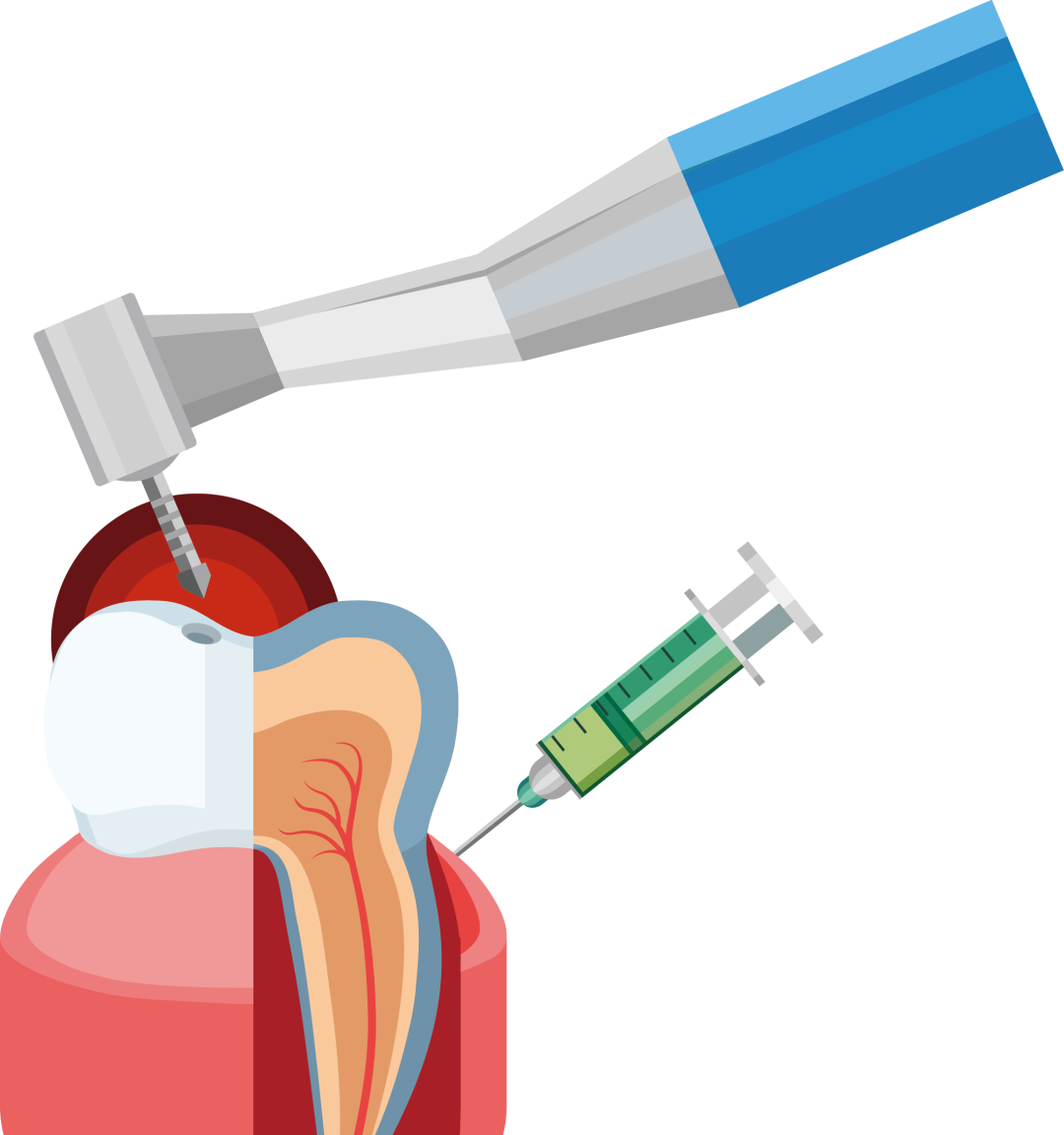 牙科手机怎么注油后悔没有早知道：牙科手机的保养事项_https://www.jmylbn.com_新闻资讯_第7张