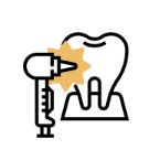 什么叫口腔器械口腔开业所需器械一网打尽_https://www.jmylbn.com_新闻资讯_第3张