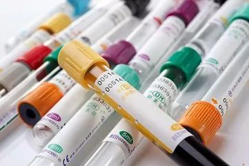 采血管颜色代表什么【冷知识】为什么抽血时，会用不同颜色的采血管？_https://www.jmylbn.com_新闻资讯_第14张