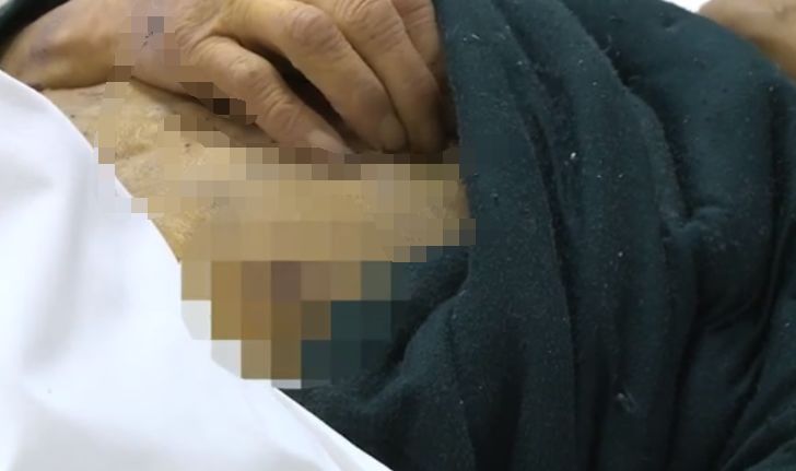 



身上痒没当回事，一查竟是癌 ！连手术机会都没了...
