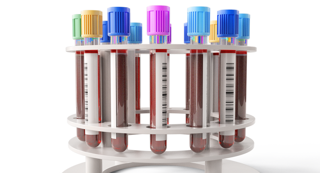 装血的容器叫什么冷知识！五颜六色的采血管到底有什么奥秘？不同颜色对应不同功能？_https://www.jmylbn.com_新闻资讯_第2张