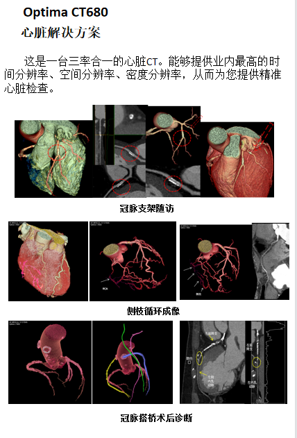 Optima什么医疗【医疗动态】我院又添新“利器”！引进美国GE高端128层CT—Optima CT680_https://www.jmylbn.com_新闻资讯_第2张