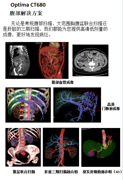 Optima什么医疗【医疗动态】我院又添新“利器”！引进美国GE高端128层CT—Optima CT680_https://www.jmylbn.com_新闻资讯_第4张