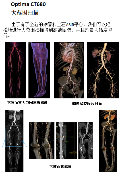 Optima什么医疗【医疗动态】我院又添新“利器”！引进美国GE高端128层CT—Optima CT680_https://www.jmylbn.com_新闻资讯_第6张