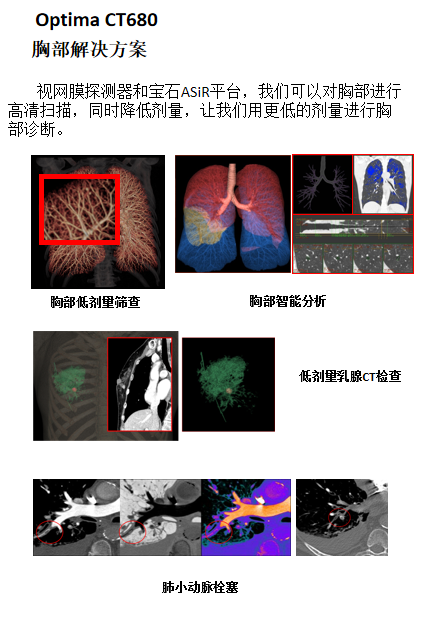 Optima什么医疗【医疗动态】我院又添新“利器”！引进美国GE高端128层CT—Optima CT680_https://www.jmylbn.com_新闻资讯_第3张