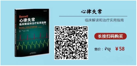 动态心电图仪器怎么看动态心电图的规范化（收藏版）_https://www.jmylbn.com_新闻资讯_第2张
