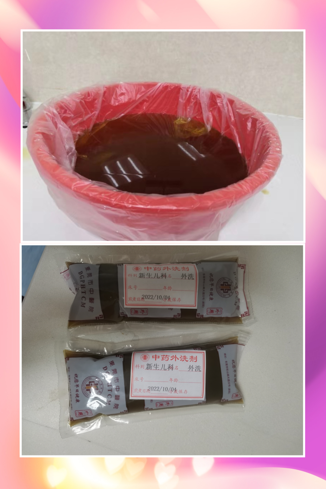 婴儿蓝光机怎么买新生儿变“小黄人”，除了蓝光治疗，中医药浴和小儿推拿也了解一下_https://www.jmylbn.com_新闻资讯_第10张