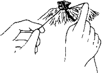 痔疮套扎吻合器怎么用无痛微创套扎治疗，让“有痔之士”轻松除痔_https://www.jmylbn.com_新闻资讯_第5张