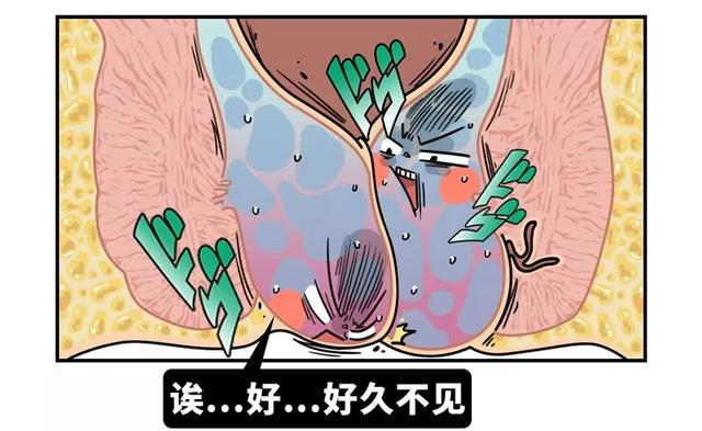 痔疮套扎吻合器怎么用无痛微创套扎治疗，让“有痔之士”轻松除痔_https://www.jmylbn.com_新闻资讯_第4张