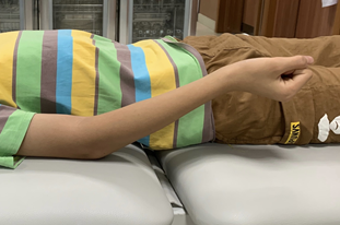 肘关节康复器怎么用专栏丨肘关节的术后康复_https://www.jmylbn.com_新闻资讯_第3张