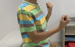 肘关节康复器怎么用专栏丨肘关节的术后康复_https://www.jmylbn.com_新闻资讯_第2张