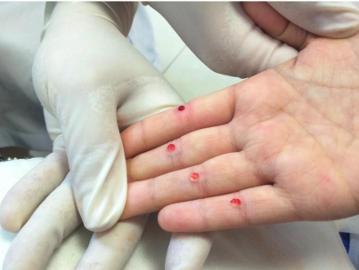 宝宝"生疳积"怎么办?宝爸宝妈注意啦