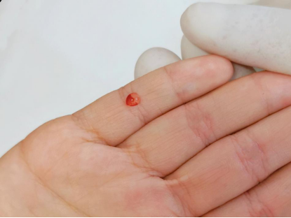 宝宝"生疳积"怎么办?宝爸宝妈注意啦