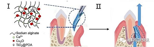 壳聚糖创伤敷料怎么样创面敷料、骨缺损、肌腱损伤、口腔黏膜、心肌梗死……多场景生物医用水凝胶材料定制上线！_https://www.jmylbn.com_新闻资讯_第17张