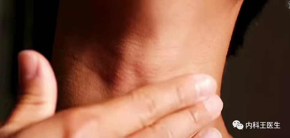 咳嗽，咳黄痰，要不要吃消炎药？