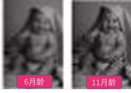 什么是屈光筛查仪小熊科普 ｜ 视力、屈光、眼轴、远视储备都是什么，听小熊君来解读_https://www.jmylbn.com_新闻资讯_第5张