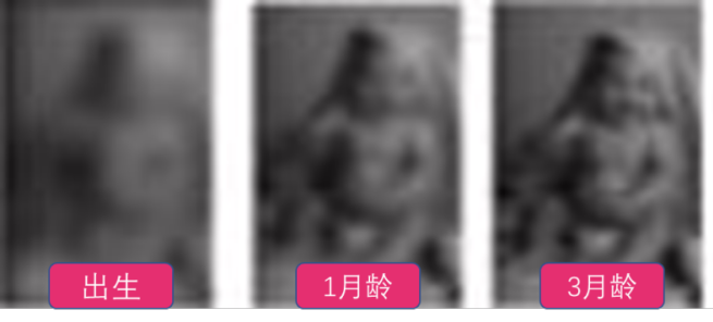 什么是屈光筛查仪小熊科普 ｜ 视力、屈光、眼轴、远视储备都是什么，听小熊君来解读_https://www.jmylbn.com_新闻资讯_第4张