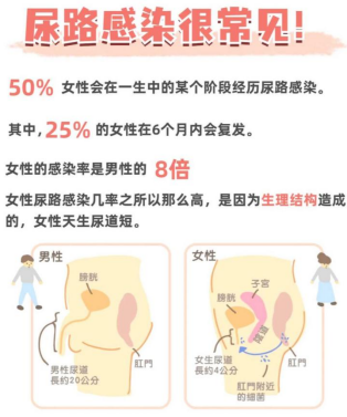 为什么要引流尿袋【健康科普】尿管居家护理，我们需要知道这些_https://www.jmylbn.com_新闻资讯_第18张