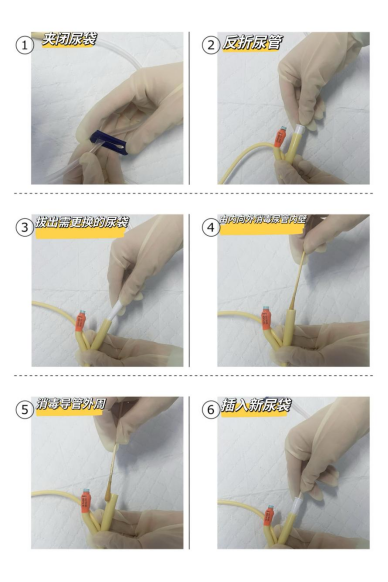 为什么要引流尿袋【健康科普】尿管居家护理，我们需要知道这些_https://www.jmylbn.com_新闻资讯_第15张