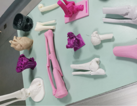 放射科怎么打印医院放射科医师登国家级平台：揭秘3D打印修复粉碎性骨折的“破局之道”_https://www.jmylbn.com_新闻资讯_第9张