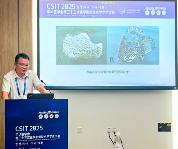 放射科怎么打印医院放射科医师登国家级平台：揭秘3D打印修复粉碎性骨折的“破局之道”_https://www.jmylbn.com_新闻资讯_第5张