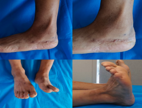 放射科怎么打印医院放射科医师登国家级平台：揭秘3D打印修复粉碎性骨折的“破局之道”_https://www.jmylbn.com_新闻资讯_第8张