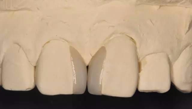 牙齿的十种美学形态与功能