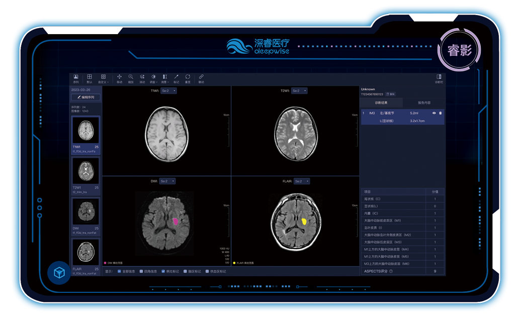 脑卒中MR AI医学辅助诊断系统.png