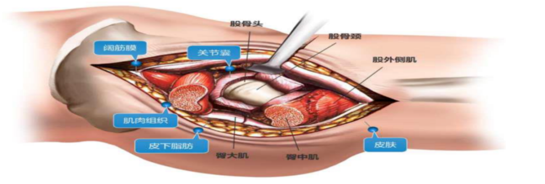 倒刺线怎么缝合TA的名字：倒刺线_https://www.jmylbn.com_新闻资讯_第23张