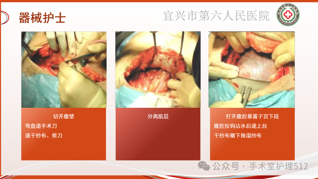 产包有什么器械子宫下段剖宫产术的手术配合_https://www.jmylbn.com_新闻资讯_第28张