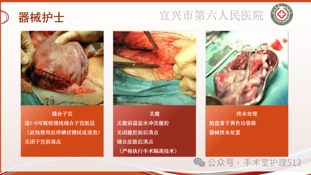 产包有什么器械子宫下段剖宫产术的手术配合_https://www.jmylbn.com_新闻资讯_第33张