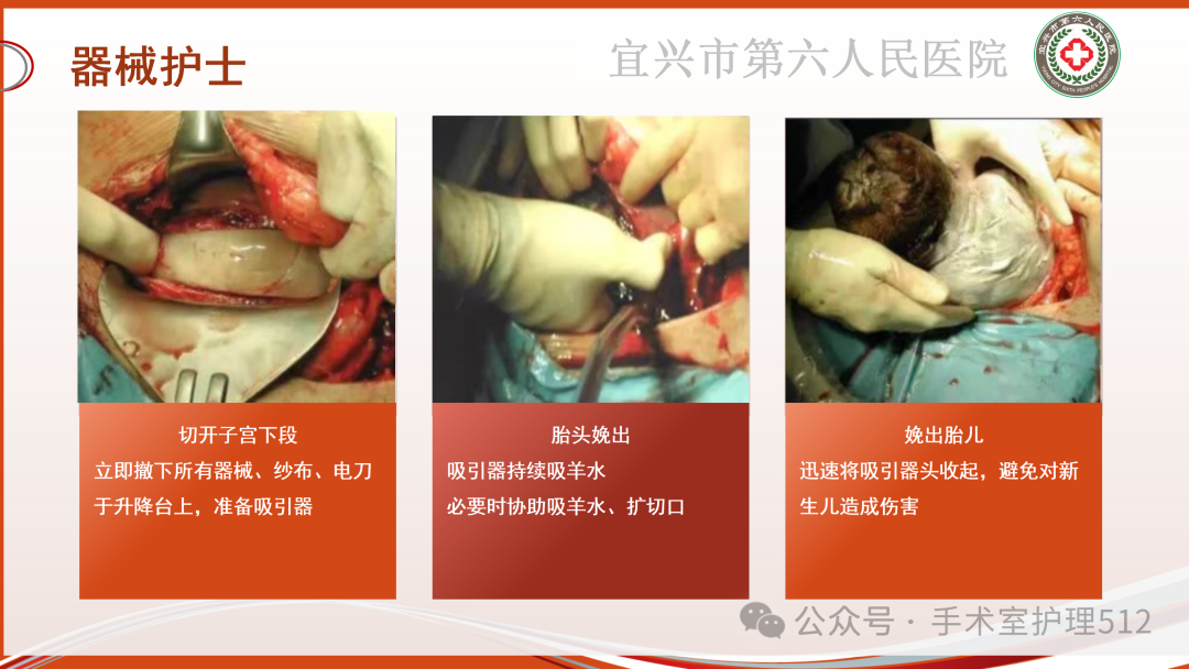 产包有什么器械子宫下段剖宫产术的手术配合_https://www.jmylbn.com_新闻资讯_第30张