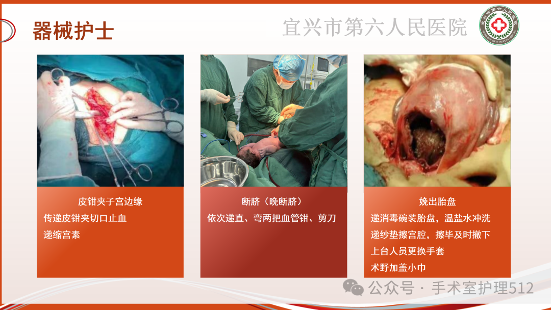 产包有什么器械子宫下段剖宫产术的手术配合_https://www.jmylbn.com_新闻资讯_第32张