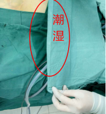 怎么穿手术器械新护士在手术室，不懂这些小心被骂_https://www.jmylbn.com_新闻资讯_第9张