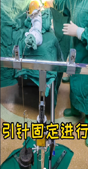 牵引床怎么用牵引床不够用怎么办？来看这家手术室DIY新型手术牵引床_https://www.jmylbn.com_新闻资讯_第8张