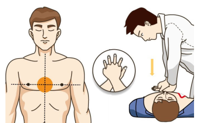 aed除颤仪怎么用AED到底怎么用，最全版讲解来啦！_https://www.jmylbn.com_新闻资讯_第13张