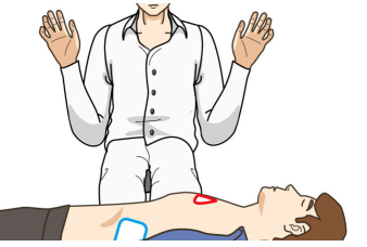 aed除颤仪怎么用AED到底怎么用，最全版讲解来啦！_https://www.jmylbn.com_新闻资讯_第11张