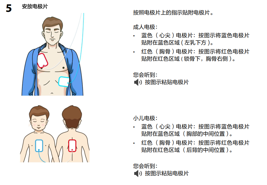 aed除颤仪怎么用AED到底怎么用，最全版讲解来啦！_https://www.jmylbn.com_新闻资讯_第10张