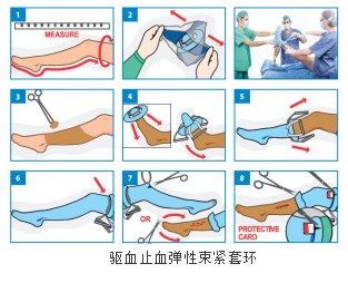 手术中怎么止血止血带在骨科手术中的应用_https://www.jmylbn.com_新闻资讯_第8张