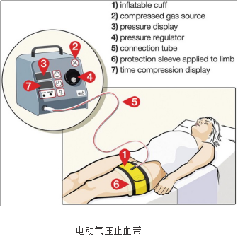 手术中怎么止血止血带在骨科手术中的应用_https://www.jmylbn.com_新闻资讯_第3张